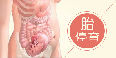 胎停育的原因